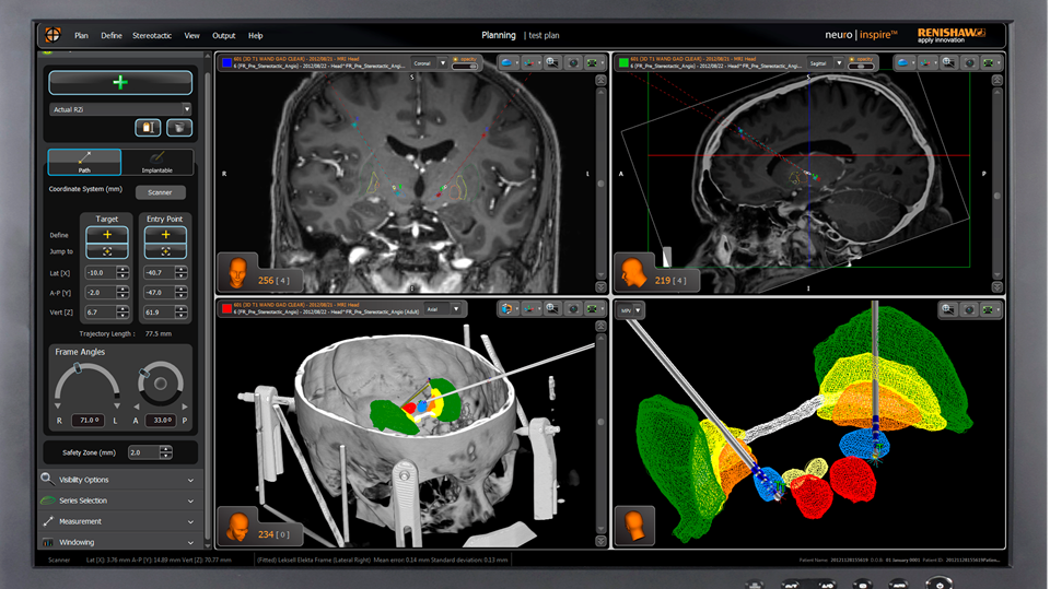 Renishaw neuroinspire™ surgical planning software